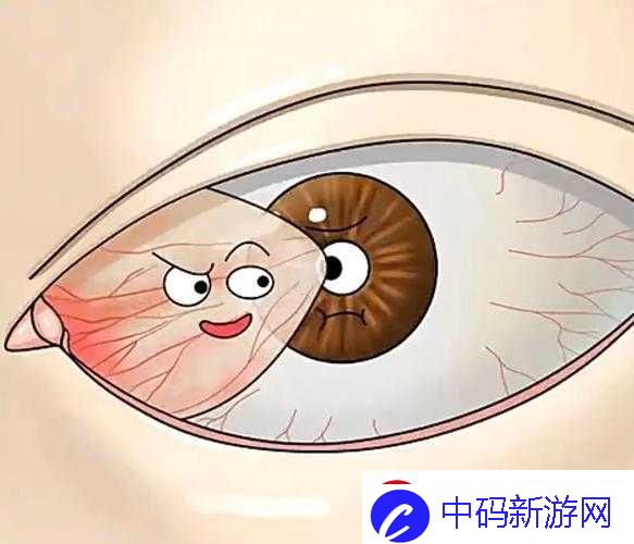 获得超级胬肉系统怎么办：如何应对获取超级胬肉系统难题